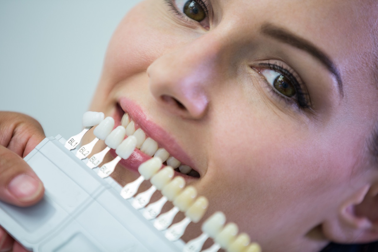 Are Laminate Veneers Cheaper in Turkey Compared to the UK?