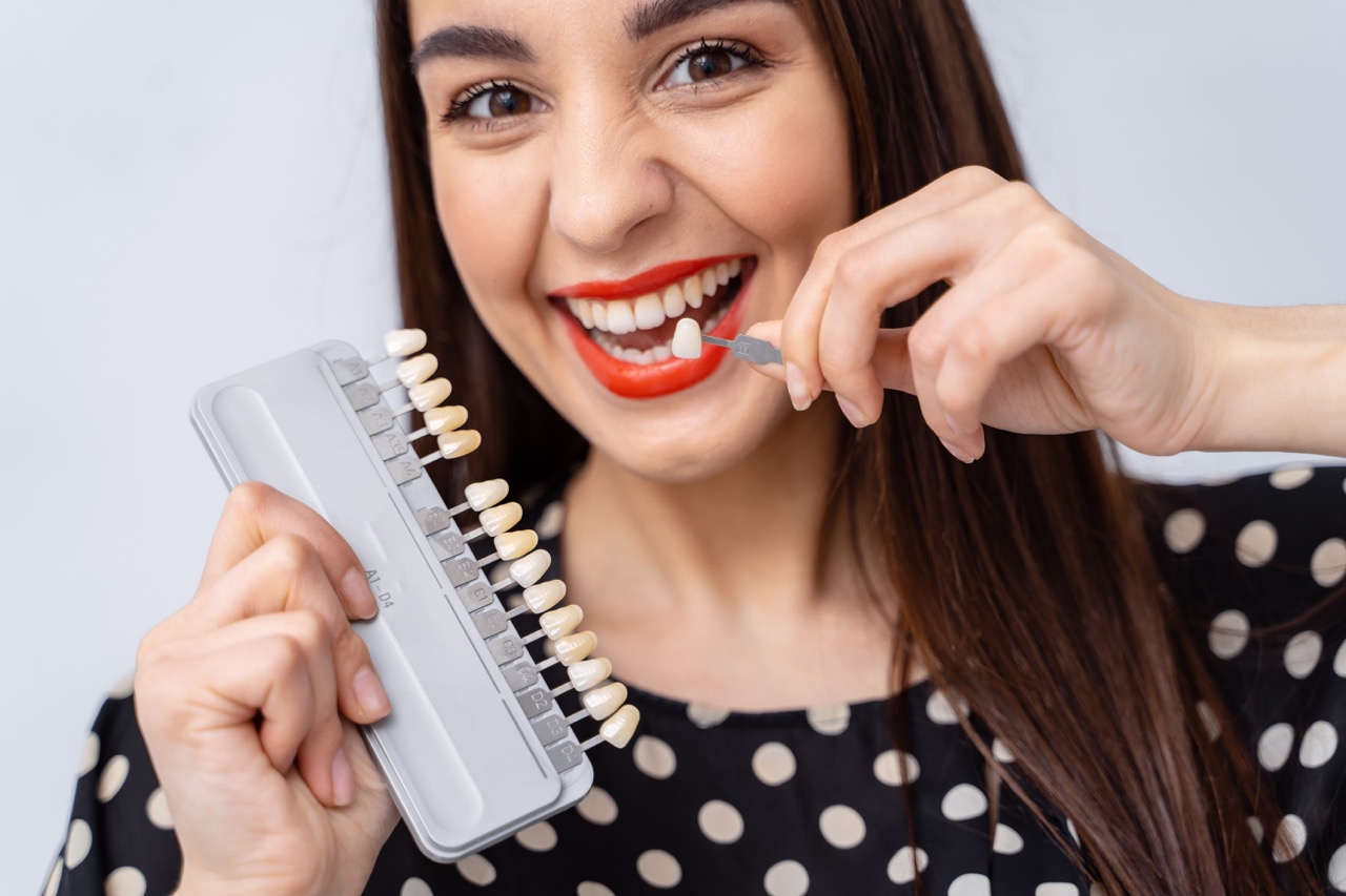 Can Laminate Veneers Be Used for All Teeth?