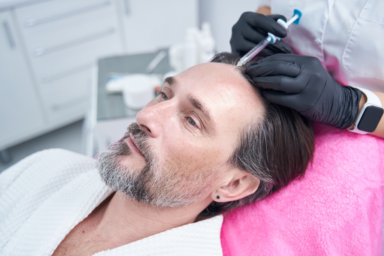 What Causes Shock Loss After Hair Transplant?