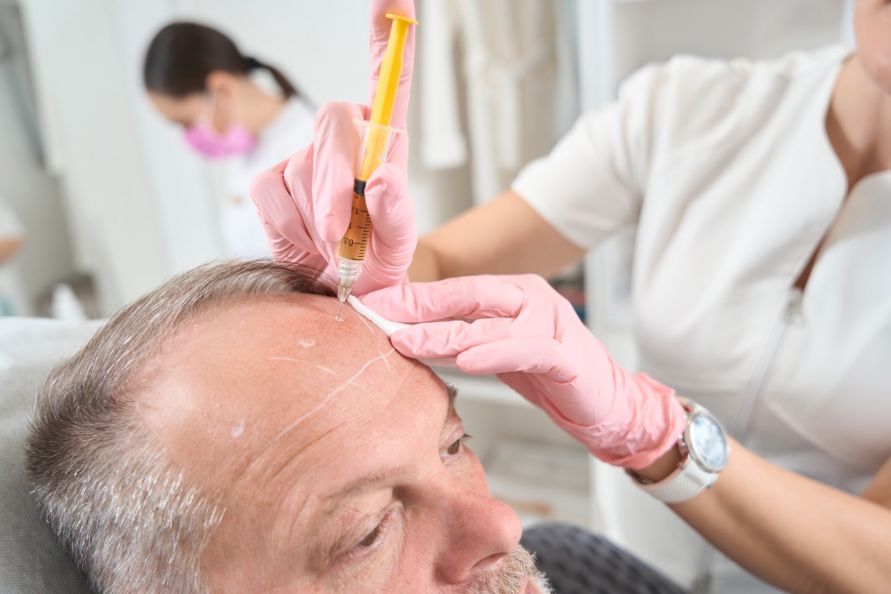 What Is the Best Age for a Hair Transplant?